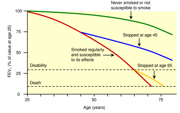 The Fletcher curve shows that the rapid decline in lung function is slowed down by smoking sessation.
